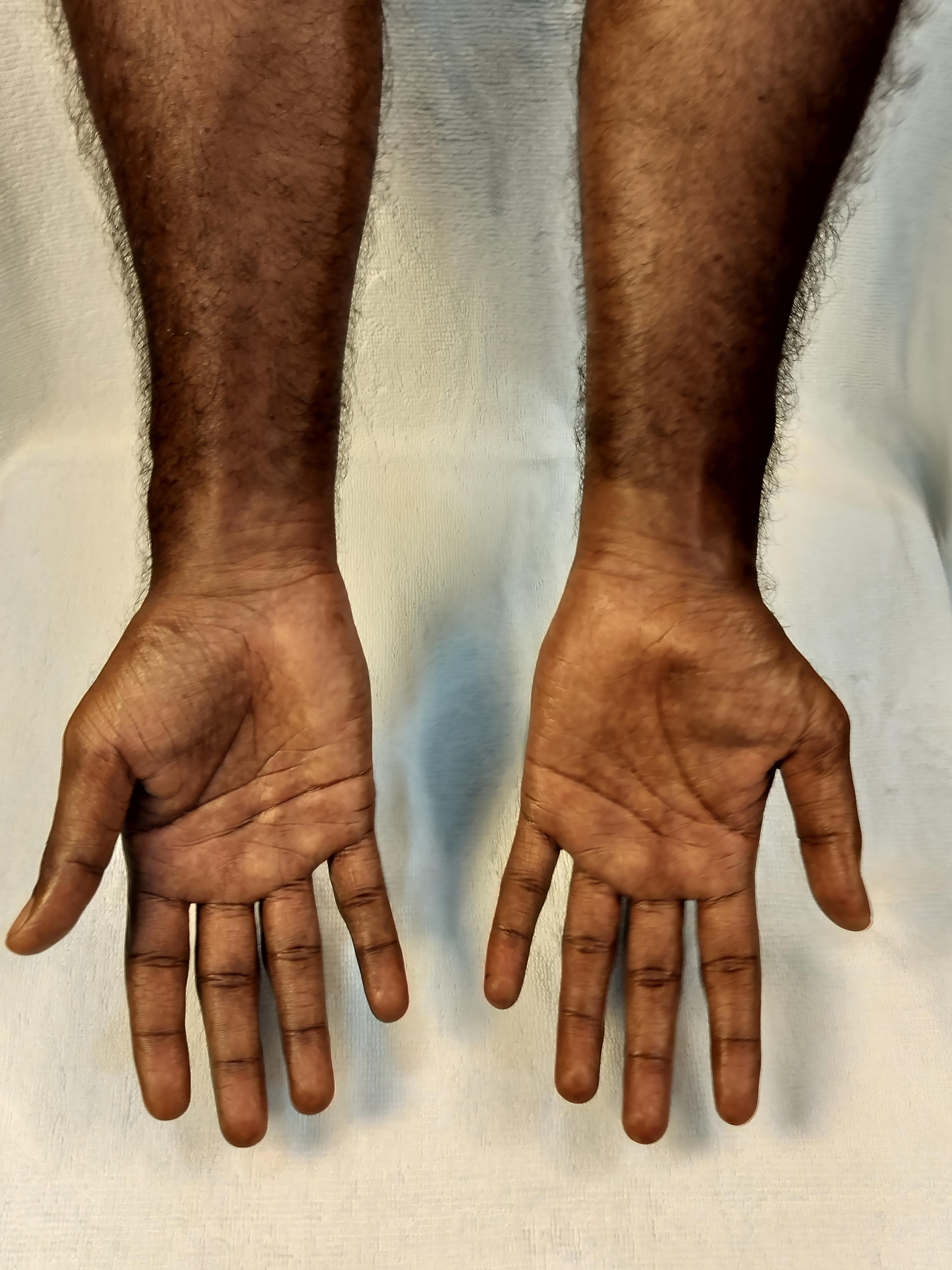 A masseur's well-maintained hands